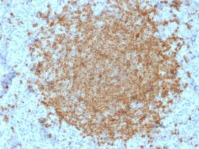 Immunohistochemistry-Paraffin: BOB1 Antibody (BOB1/2422) - Azide and BSA Free [NBP3-08637]