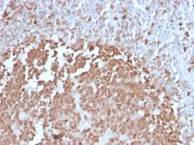 Immunohistochemistry-Paraffin: BOB1 Antibody (BOB1/2422) - Azide and BSA Free [NBP3-08637]