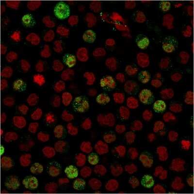 Immunocytochemistry/ Immunofluorescence: BOB1 Antibody (BOB1/2424) [NBP2-75752]