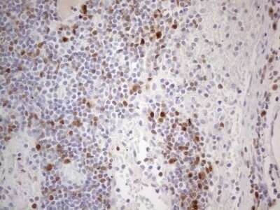 Immunohistochemistry: BOB1 Antibody (OTI2D4) - Azide and BSA Free [NBP2-71224]