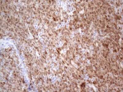 Immunohistochemistry: BOB1 Antibody (OTI2D4) - Azide and BSA Free [NBP2-71224]