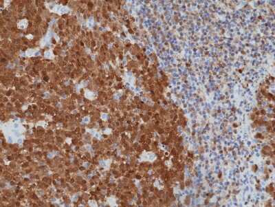 Immunohistochemistry: BOB1 Antibody (RM378) [NBP2-77435]