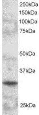 Western Blot: BOB1 Antibody [NB100-1122]