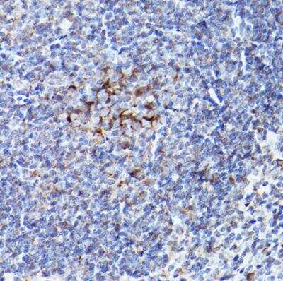 Immunohistochemistry-Paraffin: BOK Antibody - Azide and BSA Free [NBP2-92315]