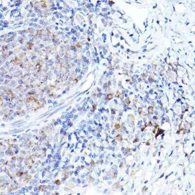 Immunohistochemistry-Paraffin: BOK Antibody - Azide and BSA Free [NBP2-92315]