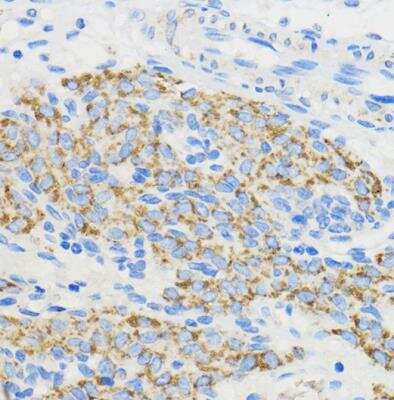 Immunohistochemistry-Paraffin: BOLA3 Antibody - Azide and BSA Free [NBP2-92289]