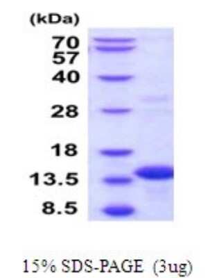SDS-PAGE: Recombinant Human BOLA3 His Protein [NBP2-52111]