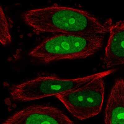 Immunocytochemistry/ Immunofluorescence: BOP1 Antibody [NBP2-33504]