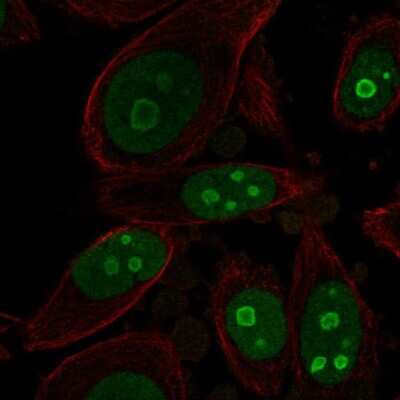 Immunocytochemistry/ Immunofluorescence: BOP1 Antibody [NBP2-56455]
