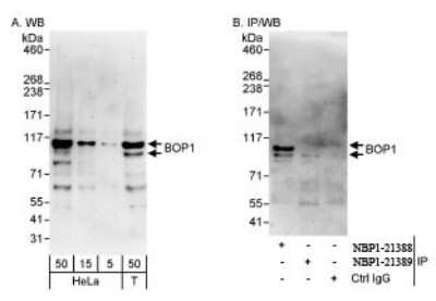 Western Blot: BOP1 Antibody [NBP1-21388]