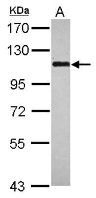 Western Blot: BOP1 Antibody [NBP2-15606]