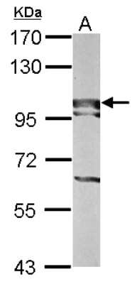 Western Blot: BOP1 Antibody [NBP2-15607]