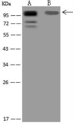 Western Blot: BOP1 Antibody [NBP3-12594]
