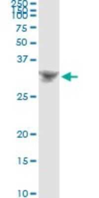 Immunoprecipitation: BP1 Antibody (1F11) [H00001748-M01]