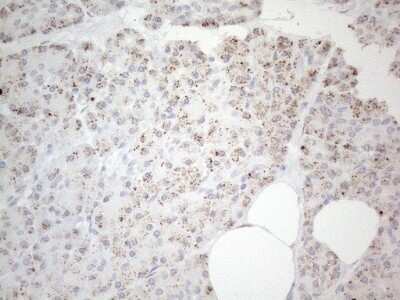 Immunohistochemistry: BP1 Antibody (OTI8A1) [NBP2-46463]