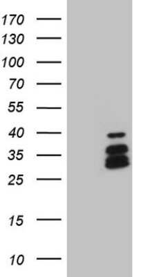 Western Blot: BP1 Antibody (OTI8A1) [NBP2-46463]