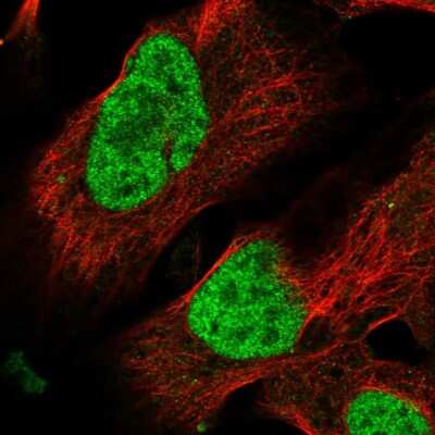 Immunocytochemistry/ Immunofluorescence: BP1 Antibody [NBP2-34130]