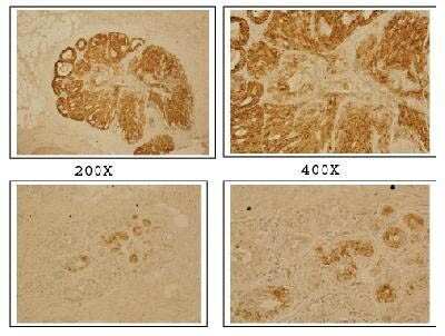 Immunohistochemistry-Frozen: BP1 Antibody [NB100-481]