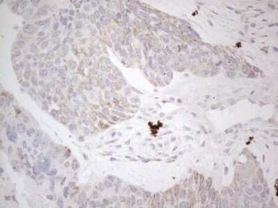 Immunohistochemistry: BP1 Antibody (OTI8A1) - Azide and BSA Free [NBP2-70581]