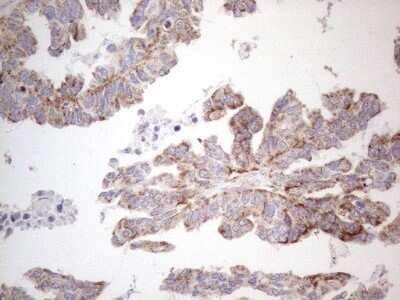 Immunohistochemistry: BP1 Antibody (OTI8A1) - Azide and BSA Free [NBP2-70581]