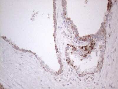 Immunohistochemistry: BP1 Antibody (OTI8A1) - Azide and BSA Free [NBP2-70581]