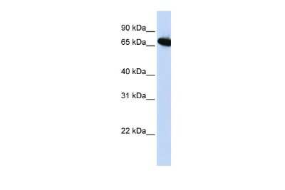 Western Blot: BP1 Antibody [NBP3-10328]