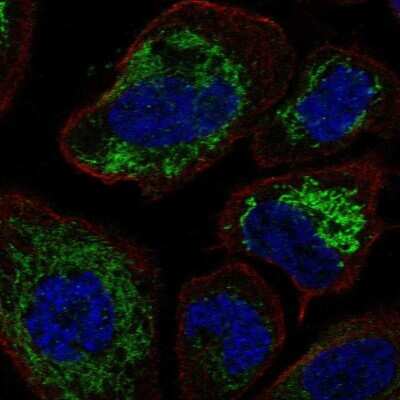 Immunocytochemistry/ Immunofluorescence: BPHL Antibody [NBP1-88373]
