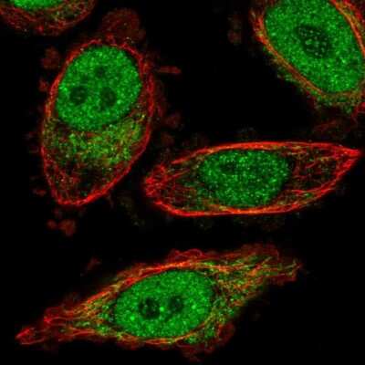 Immunocytochemistry/ Immunofluorescence: BPHL Antibody [NBP2-38328]