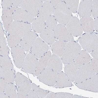 Immunohistochemistry-Paraffin: BPHL Antibody [NBP2-38328]