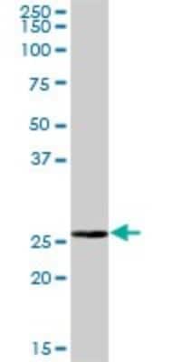 Western Blot: BPHL Antibody [H00000670-B01P]