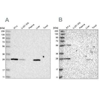 Western Blot: BPHL Antibody [NBP1-88373]
