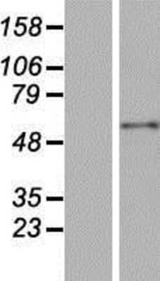 Western Blot: BPIFB1 Overexpression Lysate [NBP2-05906]