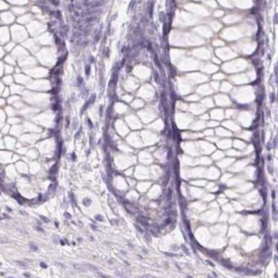 Immunohistochemistry-Paraffin: BPIL1 Antibody [NBP2-38887]