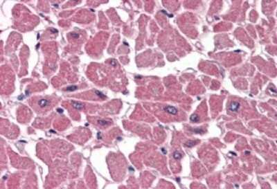 Immunohistochemistry-Paraffin: BPOZ Antibody [NB100-836]