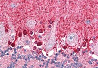 Immunohistochemistry-Paraffin: BPOZ Antibody [NB100-836]
