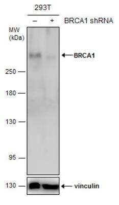 Western Blot: BRCA1 Antibody (8F7) [NBP1-41186]
