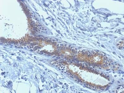 Immunohistochemistry-Paraffin: BRCA1 Antibody (BRCA1/1398) [NBP2-53251]