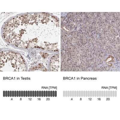 Immunohistochemistry-Paraffin: BRCA1 Antibody [NBP2-62628]