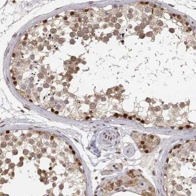 Immunohistochemistry-Paraffin: BRCA1 Antibody [NBP2-62628]