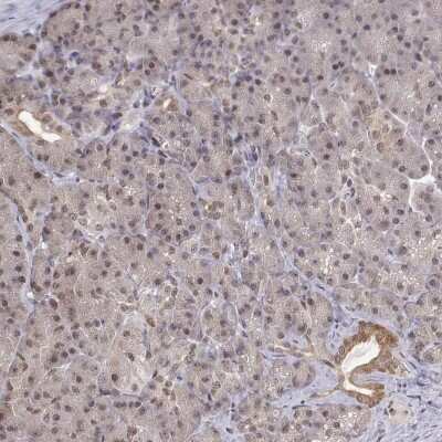 Immunohistochemistry-Paraffin: BRCA1 Antibody [NBP2-62628]