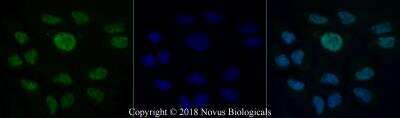 Immunocytochemistry/ Immunofluorescence: BRCA1 Antibody (KEN) - BSA Free [NB100-599]