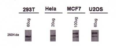 Western Blot: BRCA1 Antibody (MU)Azide and BSA Free [NBP2-80602]