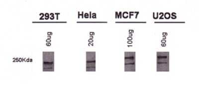 Western Blot: BRCA1 Antibody (MU) [NB100-600]