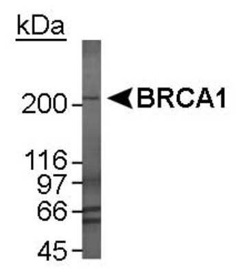 Western Blot: BRCA1 Antibody Pack [NB100-936]