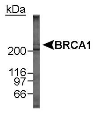 Western Blot: BRCA1 Antibody Pack [NB100-936]