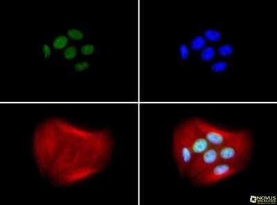 Immunocytochemistry/ Immunofluorescence: BRCA1 Antibody (RAY) - Azide and BSA Free [NBP2-80600]