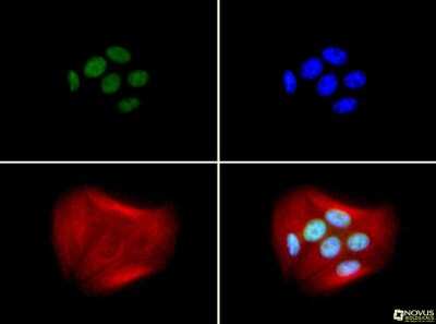Immunocytochemistry/ Immunofluorescence: BRCA1 Antibody (RAY) - BSA Free [NB100-598]