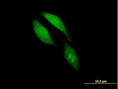 Immunocytochemistry/ Immunofluorescence: BRCC3 Antibody [H00079184-B01P]
