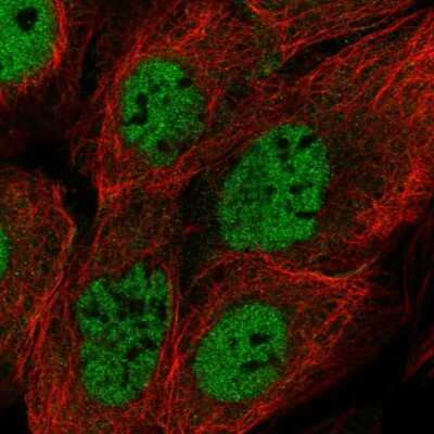 Immunocytochemistry/ Immunofluorescence: BRCC3 Antibody [NBP2-58298]