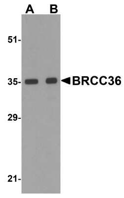 Western Blot: BRCC3 AntibodyBSA Free [NBP1-76831]